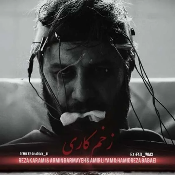 دانلود ریمیکس رضا کرمی تارا و آرمین برمایه و امیر لیام و حمیدرضا بابایی زخم کاری
